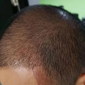 发际线分享社区