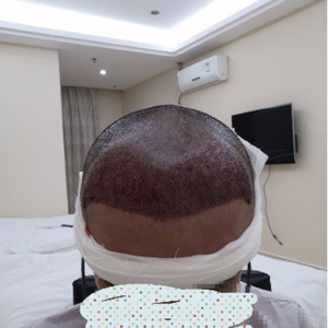 发际线分享社区