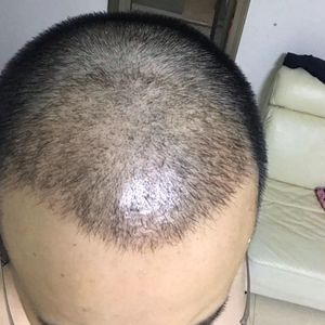 发际线分享社区