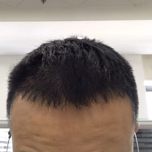 发际线分享社区