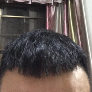 发际线分享社区