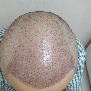 发际线分享社区