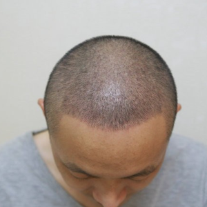 发际线分享社区