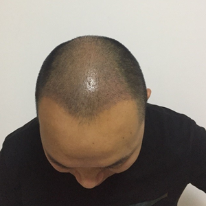 发际线分享社区