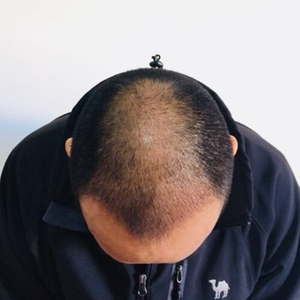 发际线分享社区