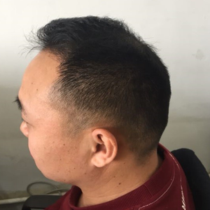 发际线分享社区