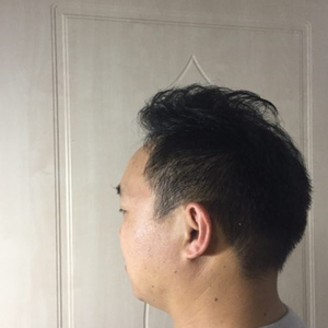 发际线分享社区