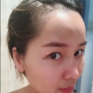 发际线分享社区