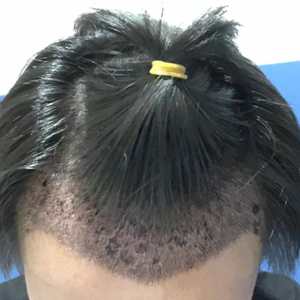 发际线分享社区