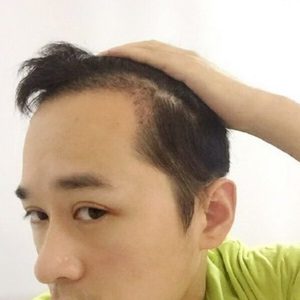 发际线分享社区