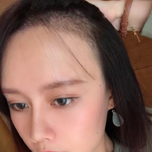 发际线分享社区