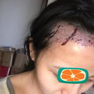 发际线分享社区