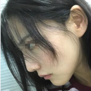 发际线分享社区