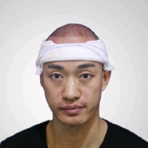 发际线分享社区