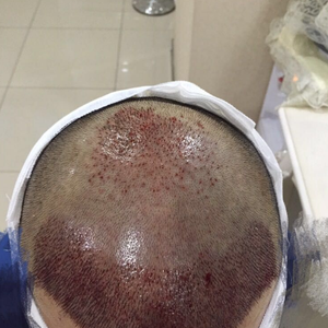 发际线分享社区