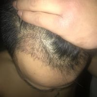 發(fā)際線用戶圖片