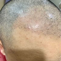 發(fā)際線用戶圖片
