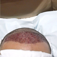 發(fā)際線用戶圖片