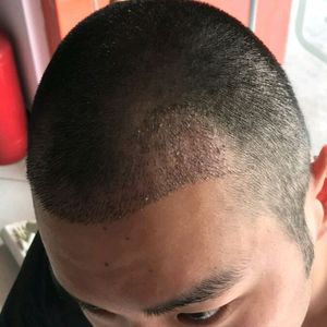 发际线分享社区