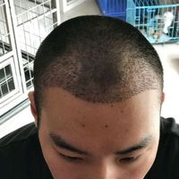 發(fā)際線用戶圖片