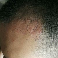 發(fā)際線用戶圖片