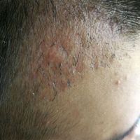 發(fā)際線用戶圖片