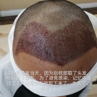 發(fā)際線用戶圖片