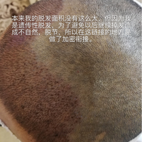 發(fā)際線用戶圖片