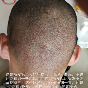 发际线分享社区