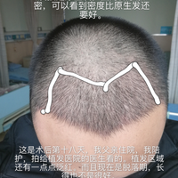 發(fā)際線用戶圖片