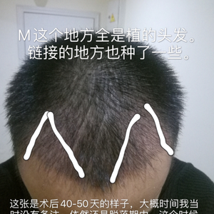 发际线分享社区