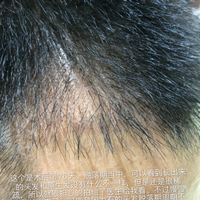 發(fā)際線用戶圖片