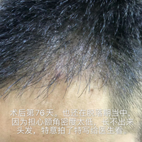 發(fā)際線用戶圖片