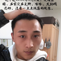 發(fā)際線用戶圖片