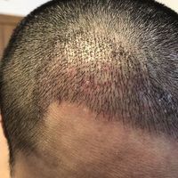 發(fā)際線用戶圖片