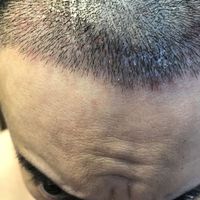 發(fā)際線用戶圖片