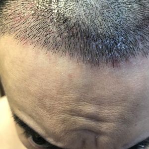 发际线分享社区
