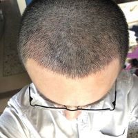 發(fā)際線用戶圖片