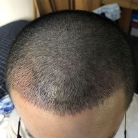 發(fā)際線用戶圖片