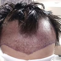 發(fā)際線用戶圖片