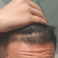 發(fā)際線用戶圖片