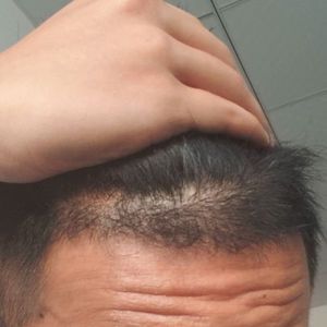 发际线分享社区