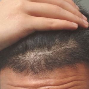 发际线分享社区