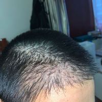 發(fā)際線用戶圖片