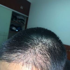 发际线分享社区