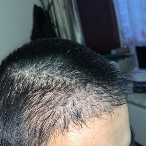 发际线分享社区