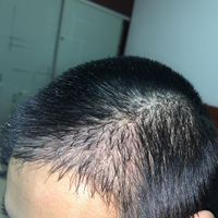 發(fā)際線用戶圖片