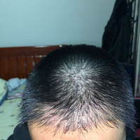 發(fā)際線用戶圖片