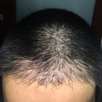 發(fā)際線用戶圖片
