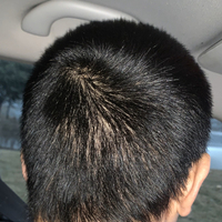 發(fā)際線用戶圖片